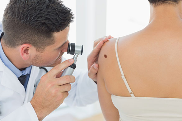 Doctor examining melanoma on woman’s back