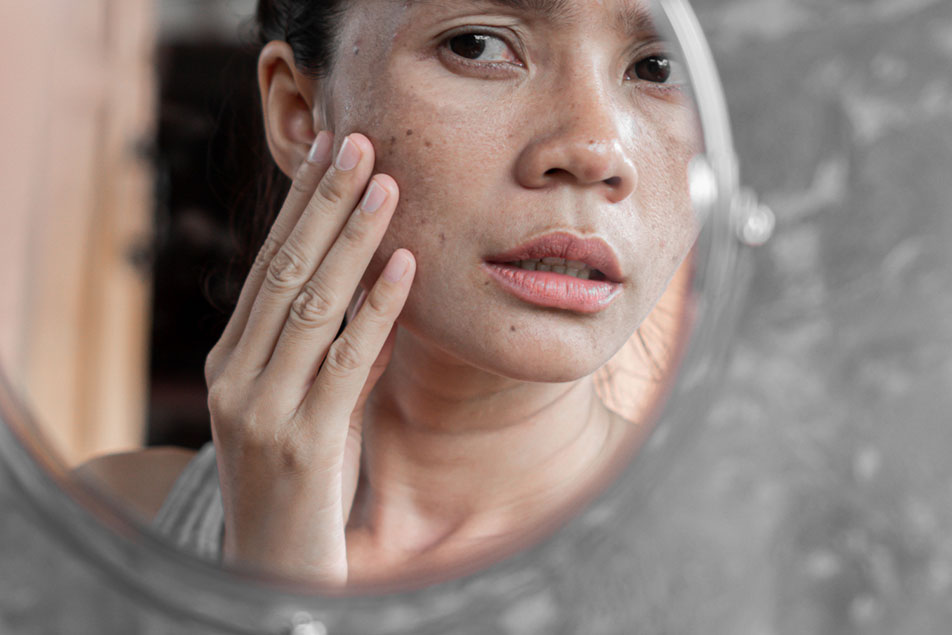 Woman checking dark spots in mirror