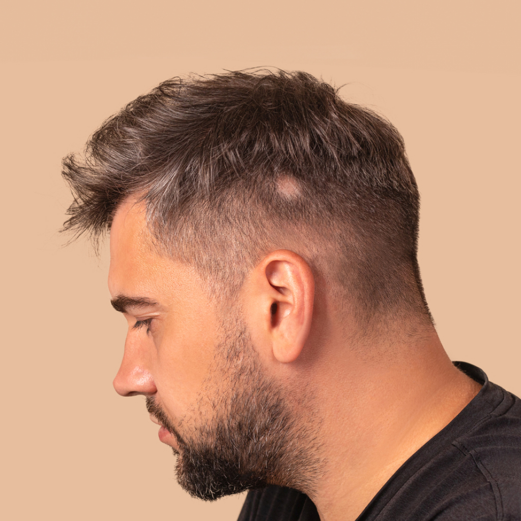 side profile of man with a bald spot on a beige background