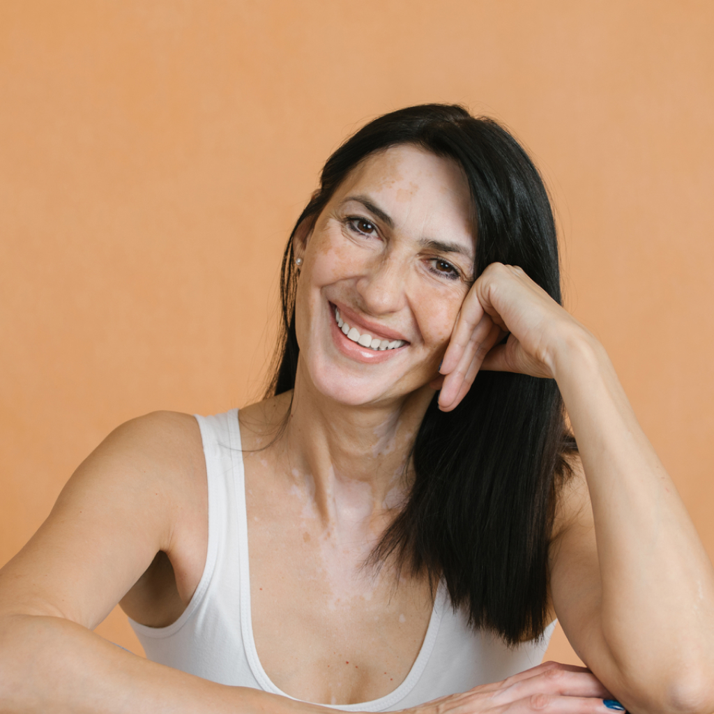 women wearing a white tank top, smiling showing her unven skintone against peach background
