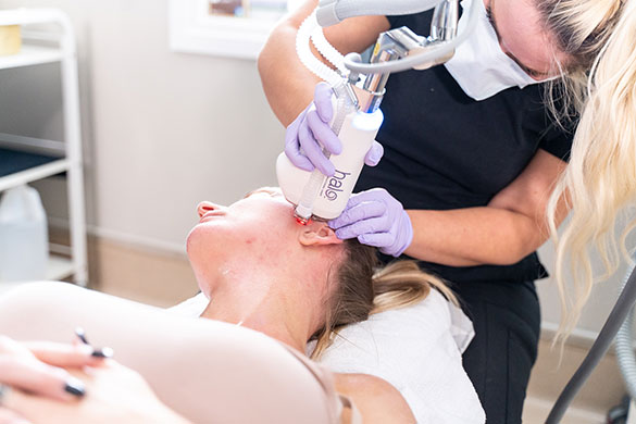 GraceMed professional performing Halo procedure on patient