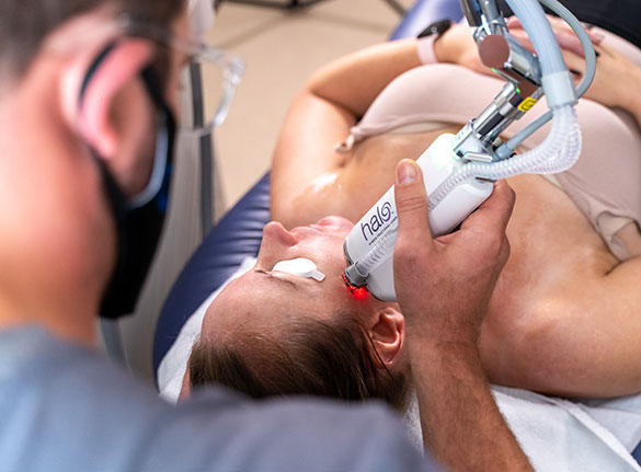 Practitioner holding halo laser to a patients face that is lying down