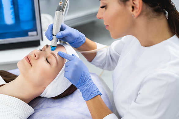 Professional performing microneedling treatment on woman’s face